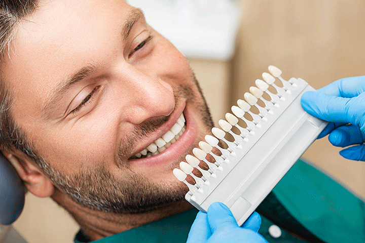 dentist matching tooth color on patient for composite filling